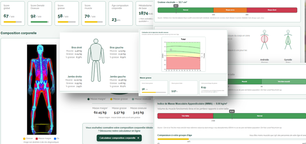 DEXA Scan Results