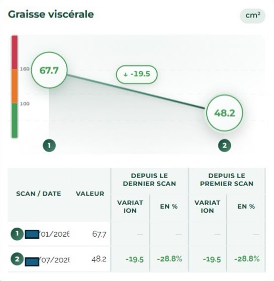 Résultat client : baisse de la graisse viscérale mesurée au DEXA