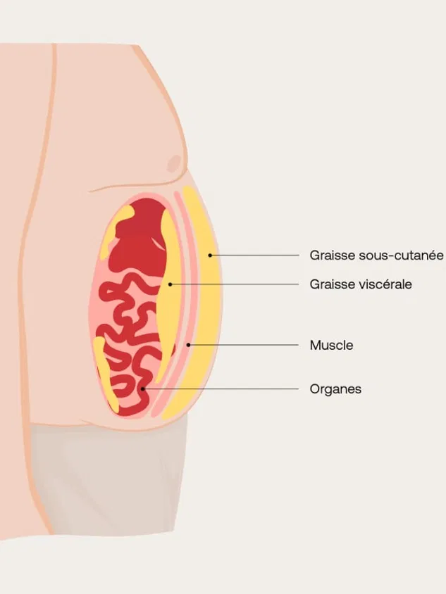 Coupe anatomique montrant la graisse sous-cutanée, la graisse viscérale, le muscle et les organes